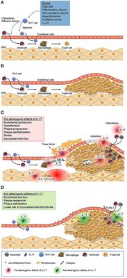 IL-17A in Psoriasis and Beyond: Cardiovascular and Metabolic Implications